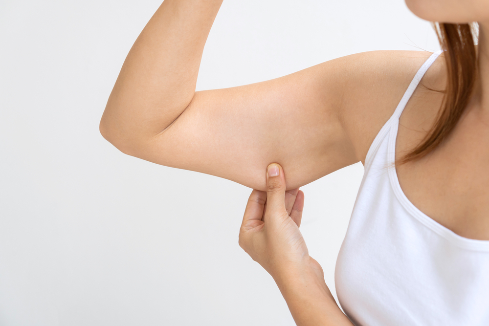 Mulher com a mão no braço - Criolipolise no braço