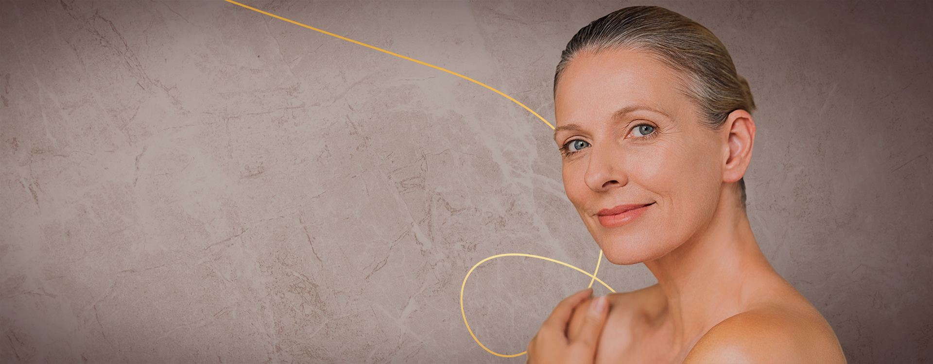 Derma V