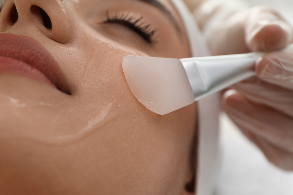 Peeling Químico