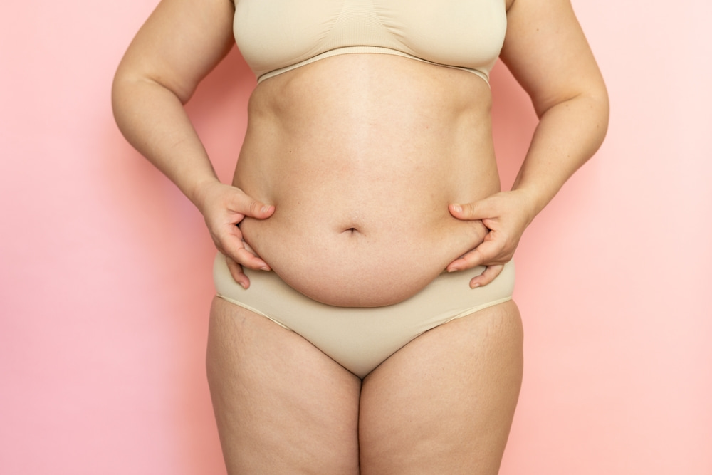 Mulher seminua com as mãos na barriga com flacidez.